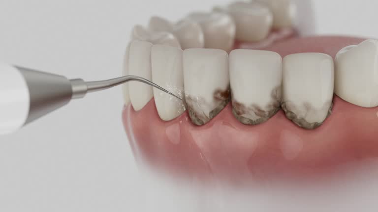 Reliable Dental Implants contractor in Midway, UT by Smile Center Dentistry